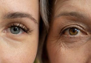 The Bloom Clinic - Sunekos Performa